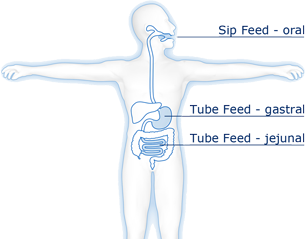 enteral nutrition (administered as sip or tube feed via the gastrointestinal tract)